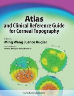 Atlas and Clinical Reference Guide for Corneal Topography (ORIGINAL PDF from Publisher)