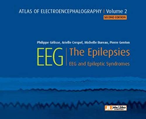 Atlas of electroencephalography:The Epilepsies. EEG and epileptic syndromes Vol 2 (ePub+Converted PDF) 1 - Medical Books & CME Courses atlas of electroencephalographythe epilepsies eeg and epileptic syndromes vol 2 epubconverted pdf 63883a8998b64 - Medical Books & CME Courses