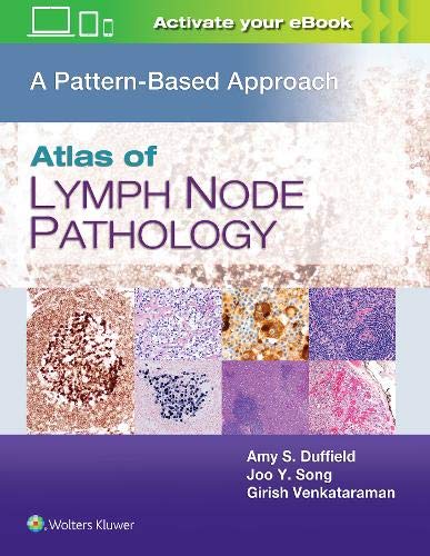 Atlas of Lymph Node Pathology: A Pattern Based Approach (ePub & Converted PDF) 1 - Medical Books & CME Courses atlas of lymph node pathology a pattern based approach epub converted pdf 638c8c771c3aa - Medical Books & CME Courses