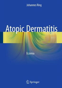 Atopic Dermatitis: Eczema (PDF) - Medicine Ebooks and Courses