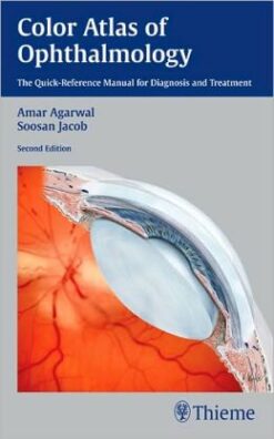 Color Atlas of Ophthalmology: The Quick-Reference Manual for Diagnosis and Treatment, 2nd Edition (ORIGINAL PDF from Publisher)