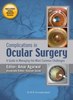 Complications in Ocular Surgery: A Guide to Managing the Most Common Challenges (ORIGINAL PDF from Publisher)