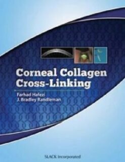 Corneal Collagen Cross Linking (ORIGINAL PDF from Publisher)