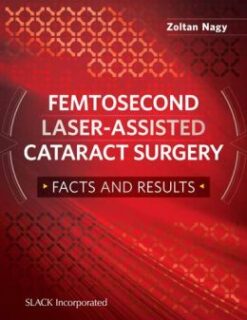Femtosecond Laser-Assisted Catarac Surgery: Facts and Results (ORIGINAL PDF from Publisher)