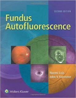 Fundus Autofluorescence, Second Edition (EPUB)