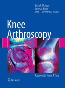 Knee Arthroscopy (PDF) - Medicine Ebooks and Courses