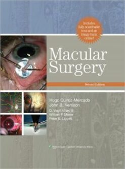 Macular Surgery, 2nd Edition (ORIGINAL PDF from Publisher)