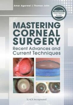 Mastering Corneal Surgery: Recent Advances and Current Techniques (ORIGINAL PDF from Publisher)