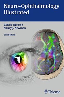 Neuro-Ophthalmology Illustrated, 2nd Edition (ORIGINAL PDF from Publisher)