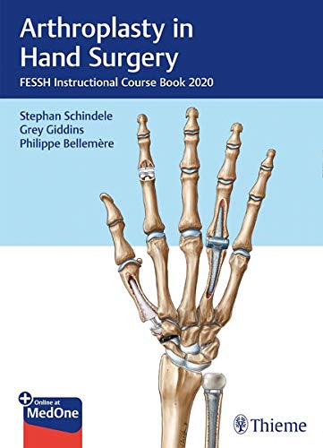 Arthroplasty in Hand Surgery: Fessh Instructional Course Book 2020 (Original PDF from Publisher) 1 | Medical Books & CME Courses arthroplasty in hand surgery fessh instructional course book 2020 original pdf from publisher 63a0bbc259ca3 | Medical Books & CME Courses