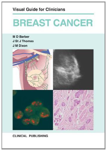 Breast Cancer: Visual Guide for Clinicians (Original PDF from Publisher ...