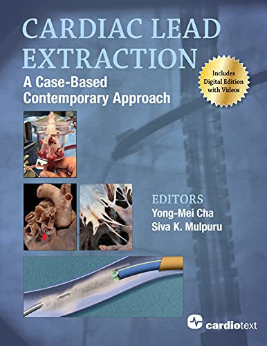 cardiac lead extraction a case based contemporary approach original pdf from publisher 63a17c814ea07 | Medical Books & CME Courses