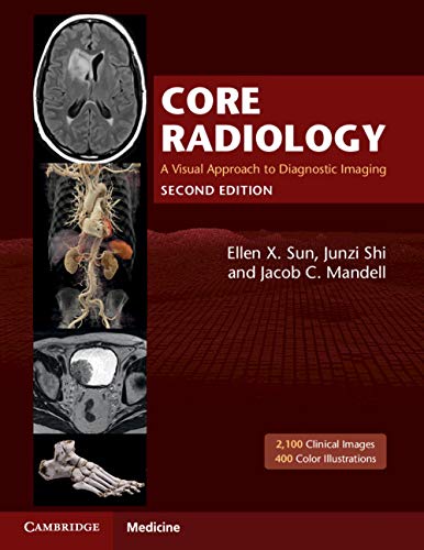 core radiology a visual approach to diagnostic imaging 2nd edition original pdf from publisher 63a0acf570f0c | Medical Books & CME Courses