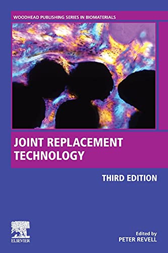 joint replacement technology 3rd edition original pdf from publisher 63a0bb297e5b6 | Medical Books & CME Courses