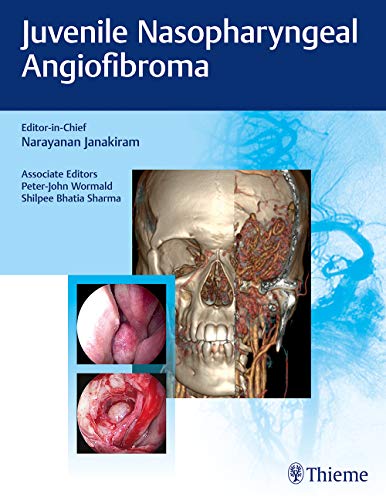 Juvenile Nasopharyngeal Angiofibroma (Original PDF from Publisher) 1 | Medical Books & CME Courses juvenile nasopharyngeal angiofibroma original pdf from publisher 638cadb9c4755 | Medical Books & CME Courses