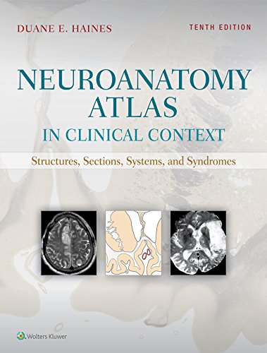 Neuroanatomy Atlas in Clinical Context: Structures, Sections, Systems, and Syndromes, 10th Edition (Original PDF from Publisher) 1 | Medical Books & CME Courses neuroanatomy atlas in clinical context structures sections systems and syndromes 10th edition original pdf from publisher 63a0b6500a488 | Medical Books & CME Courses