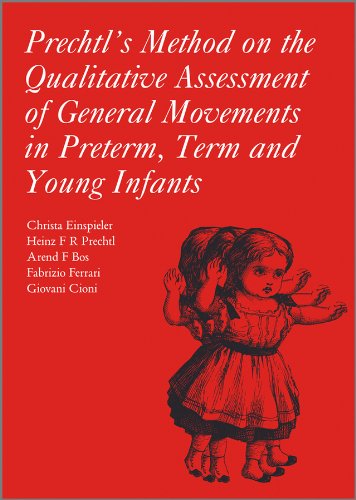 Prechtl’s Method on the Qualitative Assessment of General Movements in Preterm, Term and Young Infants (Original PDF from Publisher) 1 | Medical Books & CME Courses prechtls method on the qualitative assessment of general movements in preterm term and young infants original pdf from publisher 63a0818b04269 | Medical Books & CME Courses